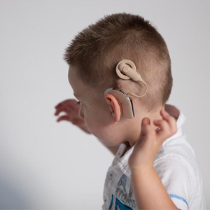 cochlear implant